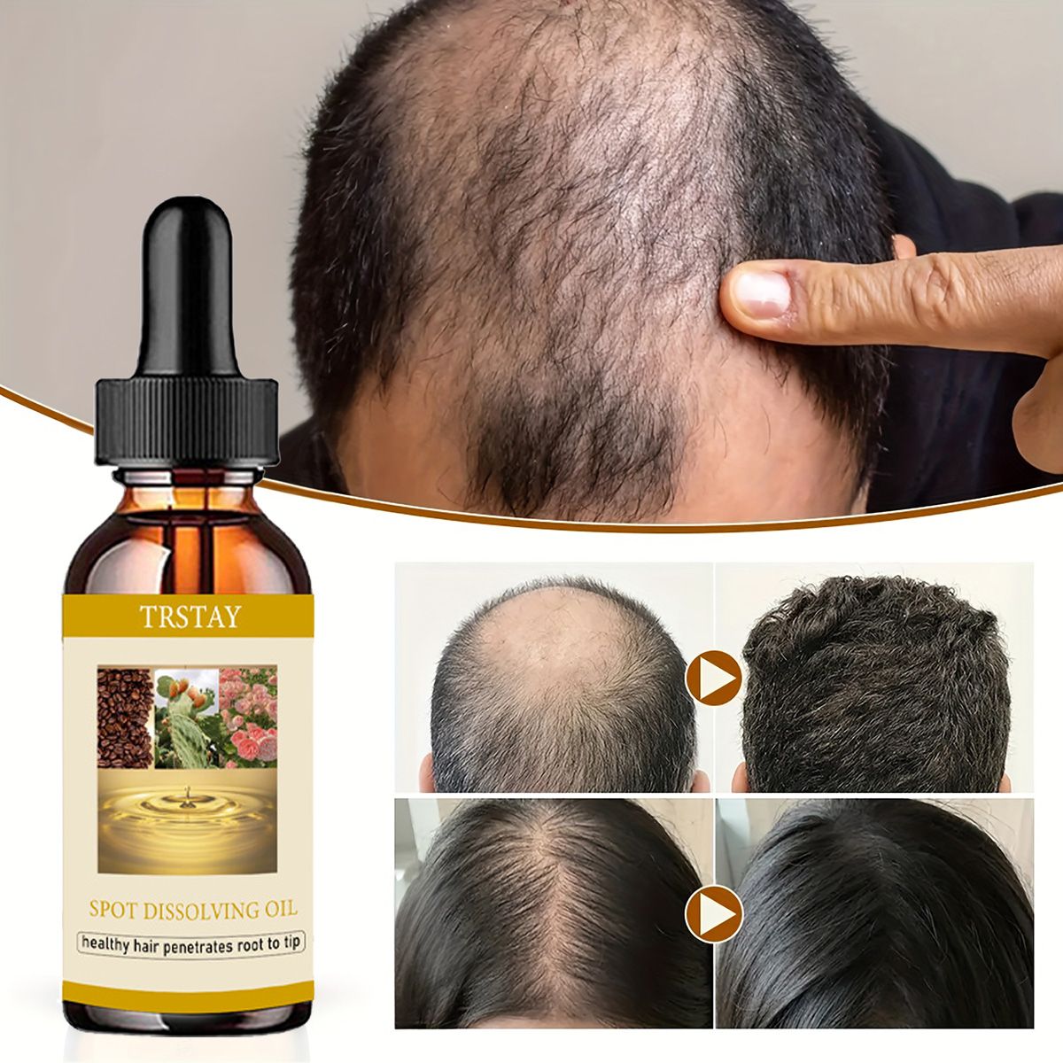 Beard Oil - 50ML Beard Growth Oil Anti Alopecia